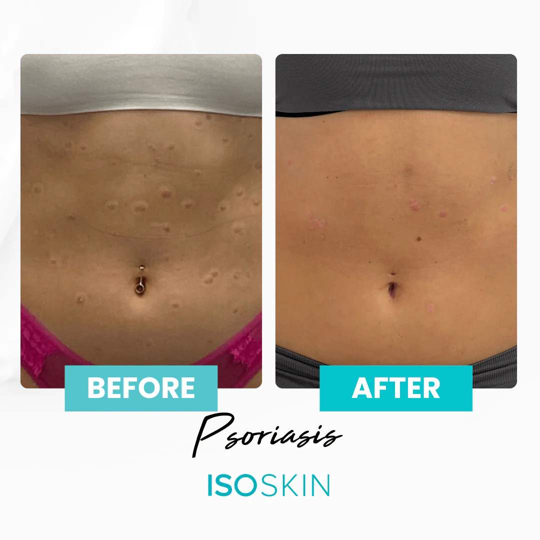 Hypochlorous Spray - Image 5