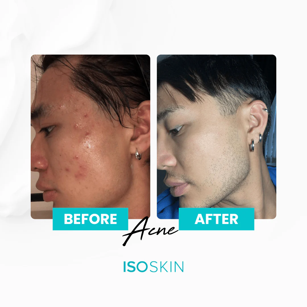 Hypochlorous Spray - Image 6